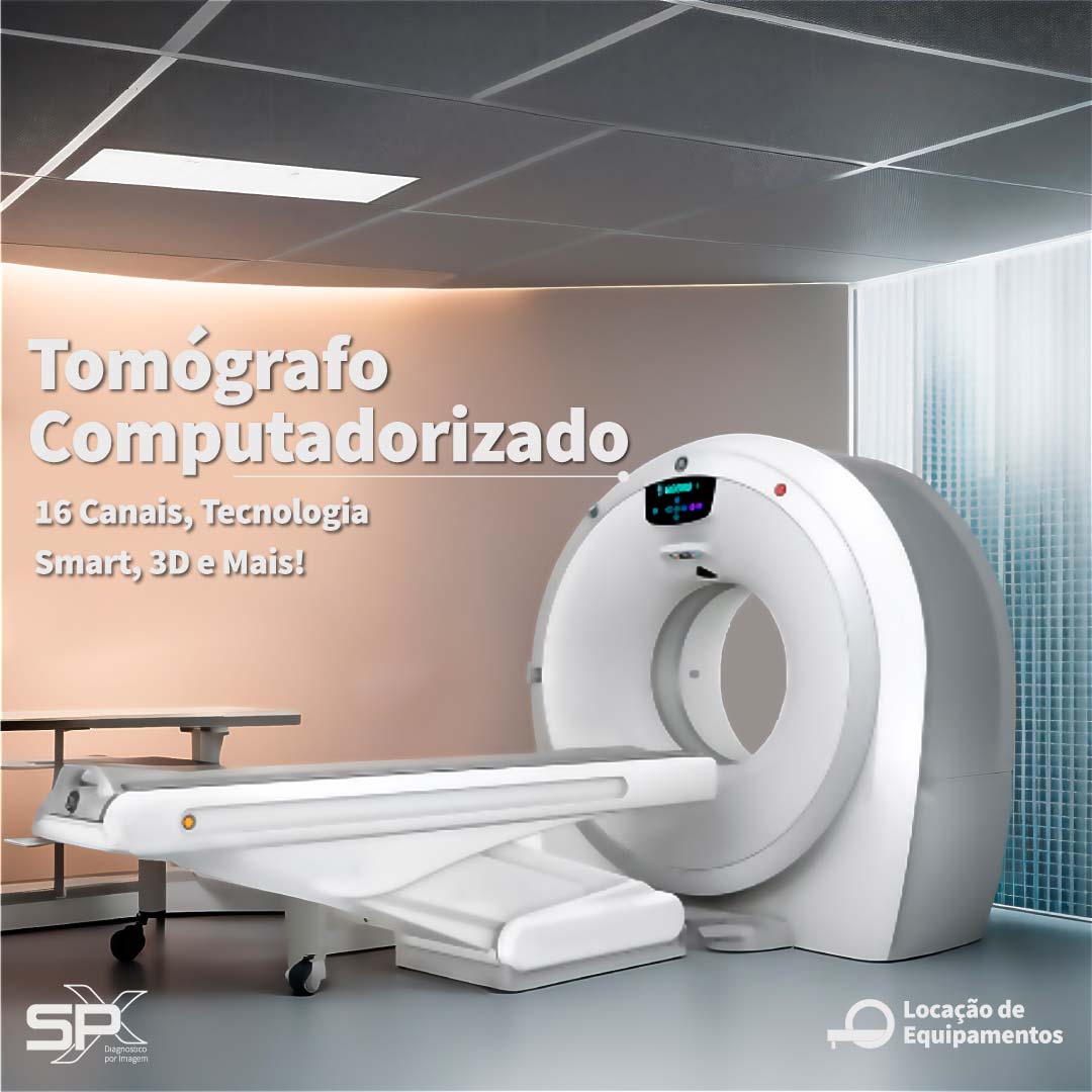 spx-clinica-spx-imagem-locação-de-equipamentos-medicos-tomografia-AI