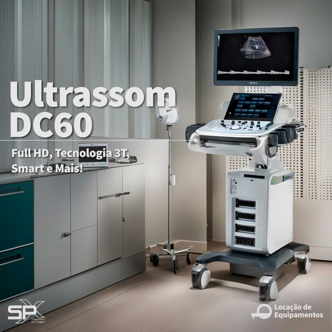 spx-clinica-spx-imagem-locação-de-equipamentos-medicos-ultrassom-digital-DC-60-IA
