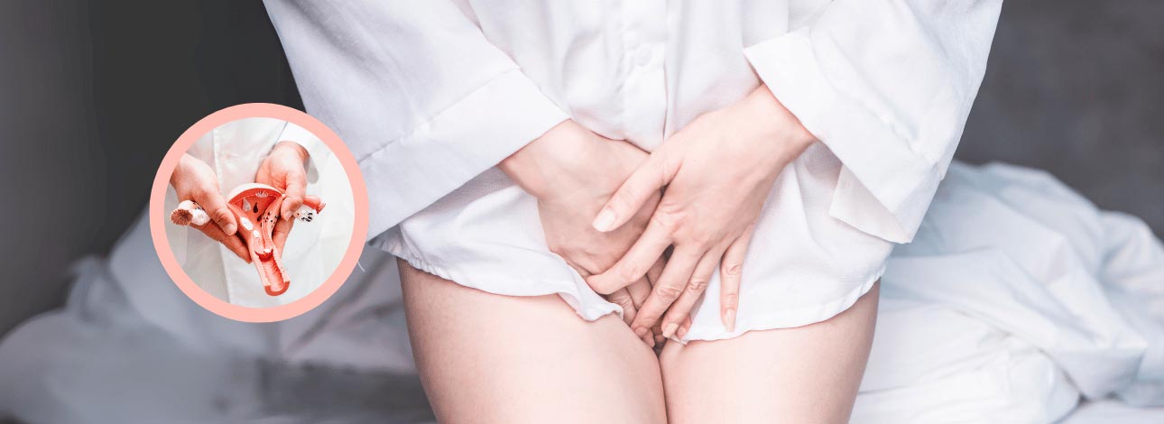 spx-clinica-spx-imagem-quais-as-causas-do-corrimento-branco