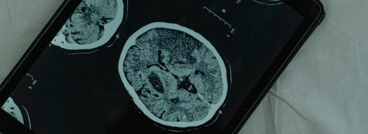 spx-clinica-spx-imagem-ia-ajuda-a-diagnosticar-epilepsia
