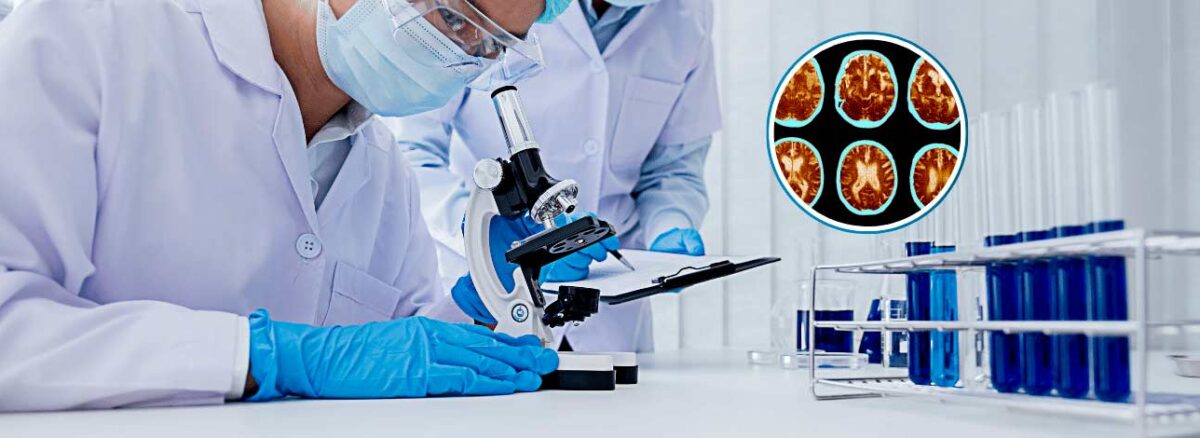 spx-clinica-spx-imagem-novo-metodo-para-controlar-sintomas-de-alzheimer