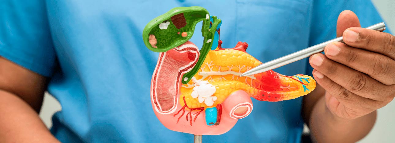 spx-clinica-spx-imagem-cancer-de-pancreas-em-mulheres