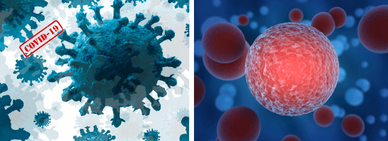 spx-clinica-spx-imagem-covid-pode-diminuir-tumores-de-cancer