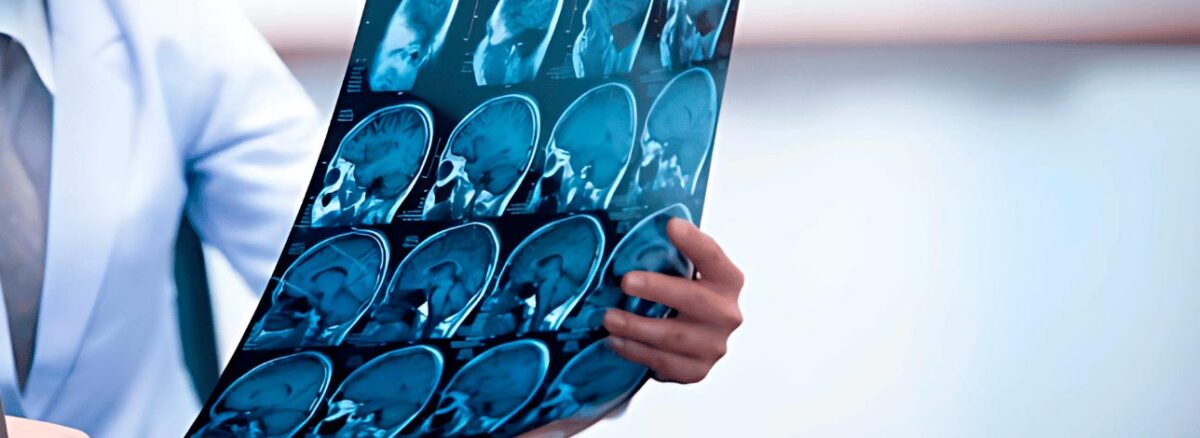 spx-clinica-spx-imagem-exame-tomografia-do-cranio