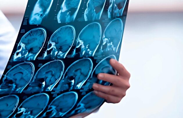 spx-clinica-spx-imagem-exame-tomografia-do-cranio