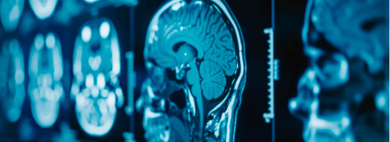 spx-clinica-spx-imagem-exames-neurologicos-para-doencas-cerebrais