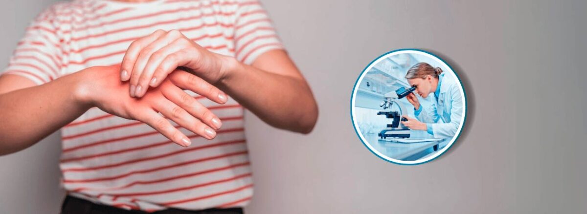 spx-clinica-spx-imagem-nova-esperanca-de-cura-para-artrite-reumatoide