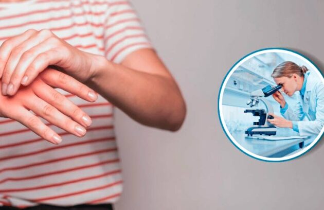 spx-clinica-spx-imagem-nova-esperanca-de-cura-para-artrite-reumatoide