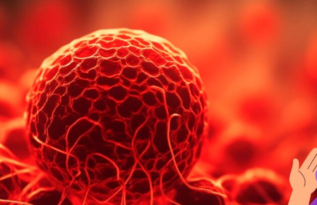 spx-clinica-spx-imagem-tipos-de-cancer-evitaveis