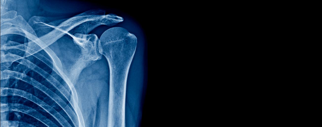 spx-clinica-spx-imagem-abrangencia-da-radiografia-na-medicina
