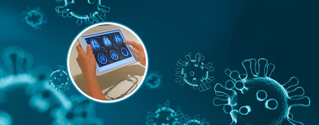 spx-clinica-spx-imagem-alzheimer-pode-surgir-a-partir-de-virus-comuns