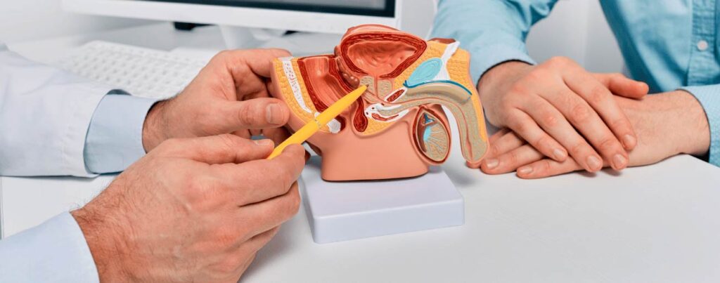 spx-clinica-spx-imagem-biomarcadores-podem-detectar-cancer-de-prostata