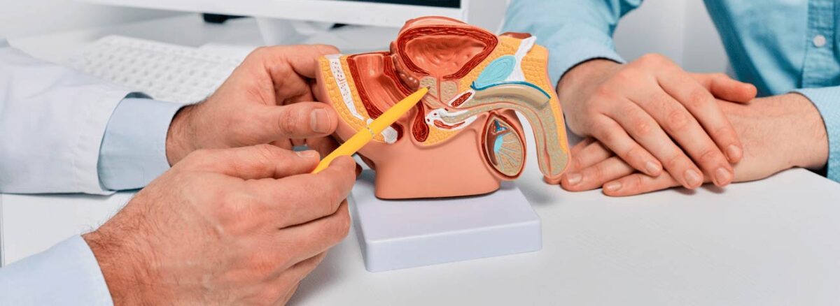 spx-clinica-spx-imagem-biomarcadores-podem-detectar-cancer-de-prostata