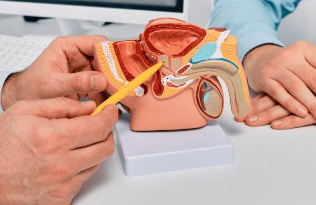spx-clinica-spx-imagem-biomarcadores-podem-detectar-cancer-de-prostata