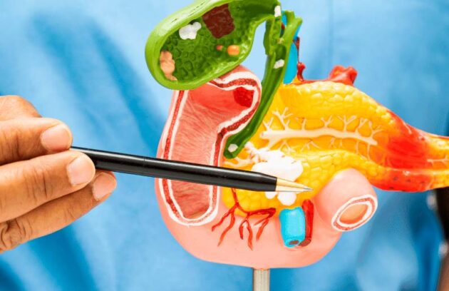 spx-clinica-spx-imagem-cancer-de-pancreas-agressivo