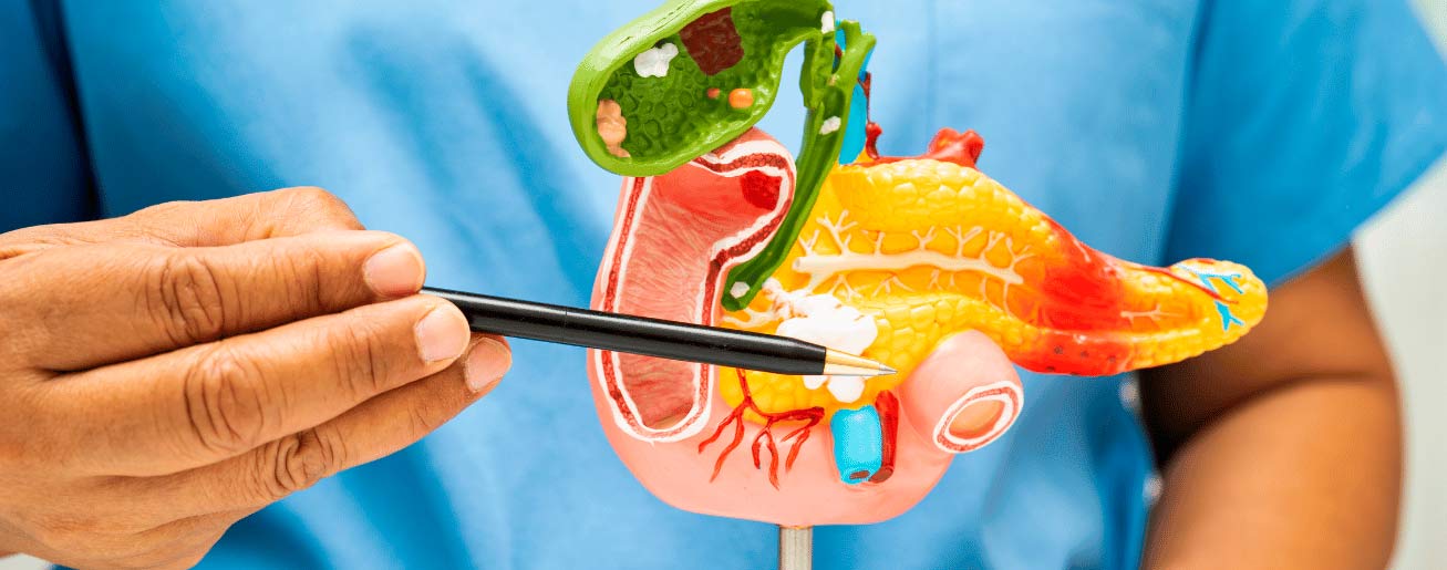 spx-clinica-spx-imagem-cancer-de-pancreas-agressivo