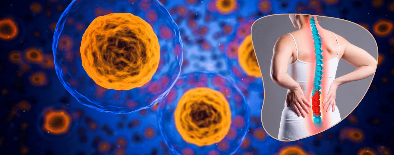 spx-clinica-spx-imagem-como-celulas-tronco-podem-tratar-lesoes-osseas