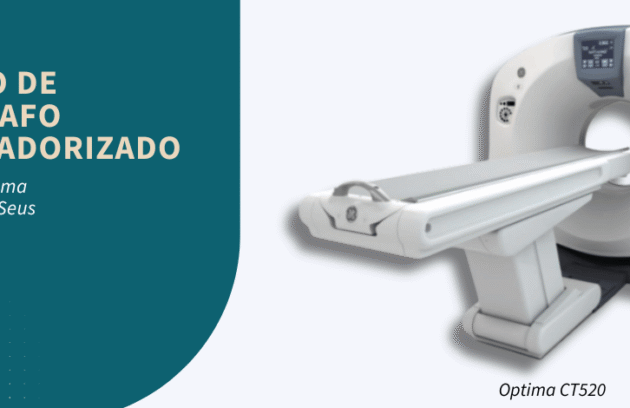 spx-clinica-spx-imagem-como-funciona-a-locacao-de-tomografo-computadorizado-capa