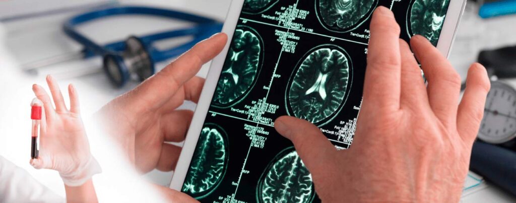 spx-clinica-spx-imagem-exame-brasileiro-detecta-alzheimer