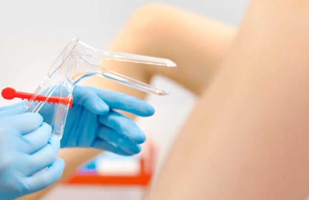 spx-clinica-spx-imagem-exame-de-papanicolau-caseiro