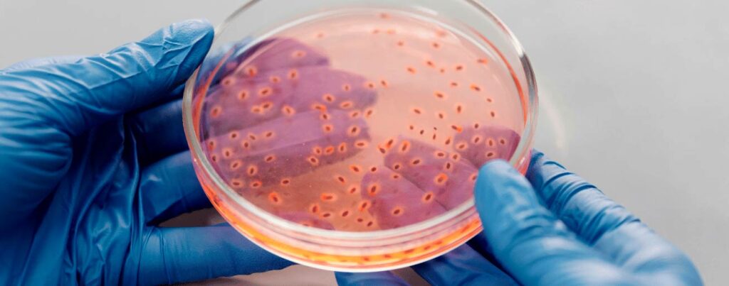 spx-clinica-spx-imagem-falencia-precoce-no-tratamento-da-hanseniase