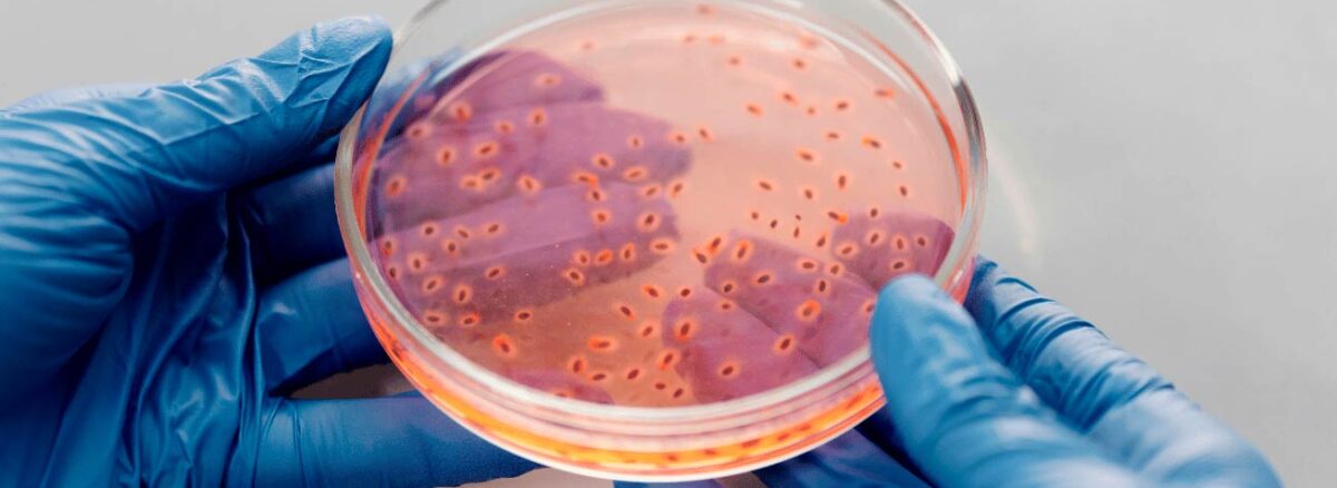 spx-clinica-spx-imagem-falencia-precoce-no-tratamento-da-hanseniase