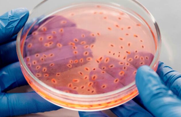 spx-clinica-spx-imagem-falencia-precoce-no-tratamento-da-hanseniase