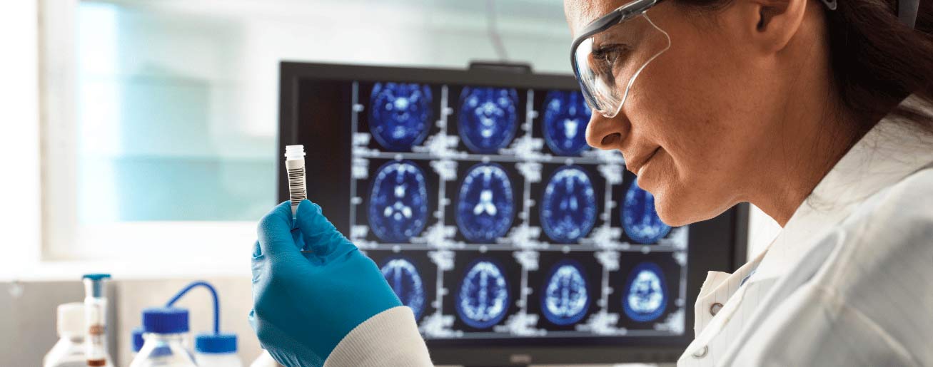 spx-clinica-spx-imagem-inovacao-exame-brasileiro-detecta-alzheimer