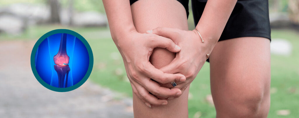 spx-clinica-spx-imagem-principais-causas-da-artrose