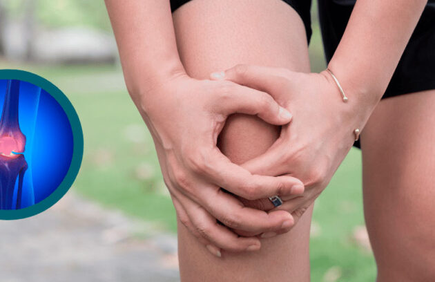 spx-clinica-spx-imagem-principais-causas-da-artrose