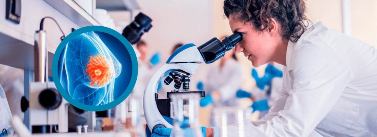 spx-clinica-spx-imagem-relacao-entre-diabetes-e-cancer-de-mama