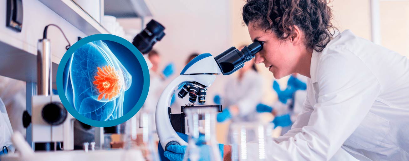 spx-clinica-spx-imagem-relacao-entre-diabetes-e-cancer-de-mama