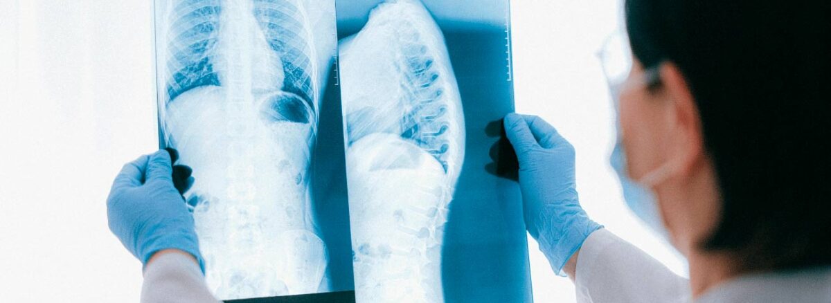 spx-clinica-spx-imagem-tipos-de-exame-de-raio-x