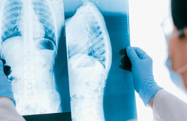 spx-clinica-spx-imagem-tipos-de-exame-de-raio-x