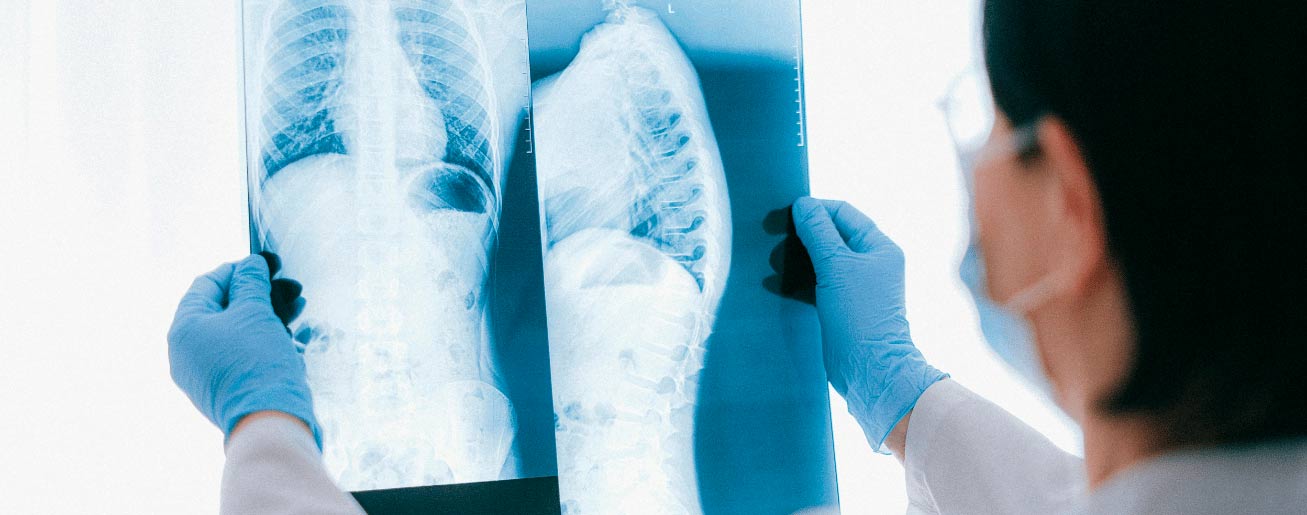 spx-clinica-spx-imagem-tipos-de-exame-de-raio-x
