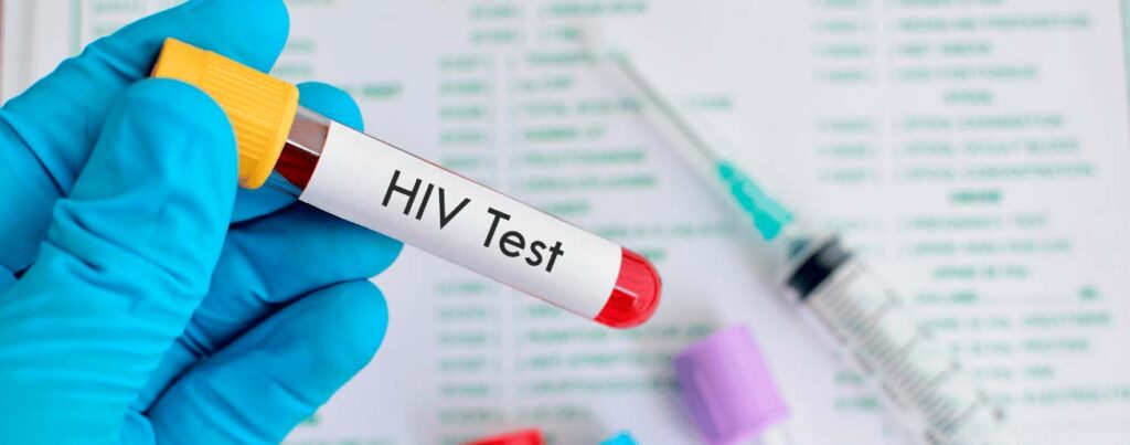 spx-clinica-spx-imagem-descoberta-cientifica-sobre-o-hiv