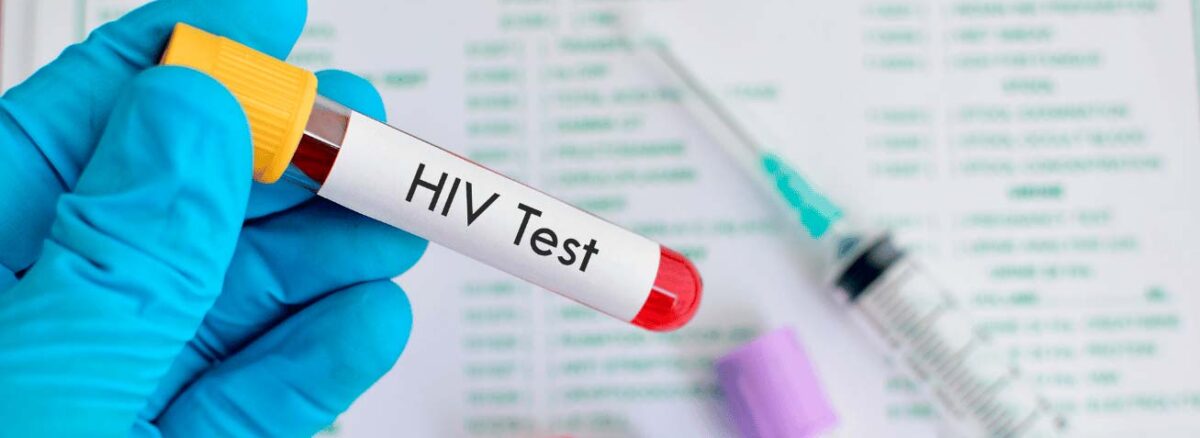 spx-clinica-spx-imagem-descoberta-cientifica-sobre-o-hiv