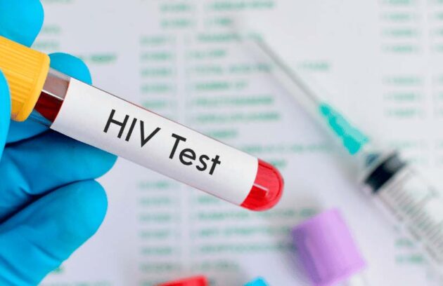 spx-clinica-spx-imagem-descoberta-cientifica-sobre-o-hiv