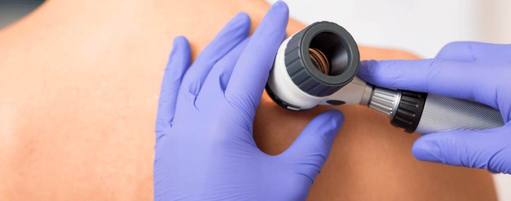 spx-clinica-spx-imagem-novo-tratamento-acelera-cura-da-hanseniase