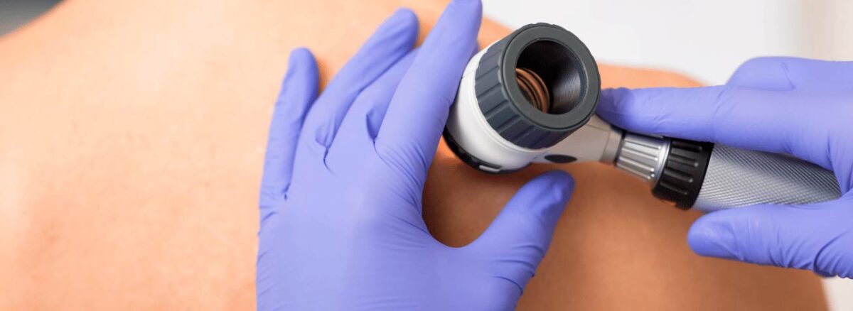 spx-clinica-spx-imagem-novo-tratamento-acelera-cura-da-hanseniase