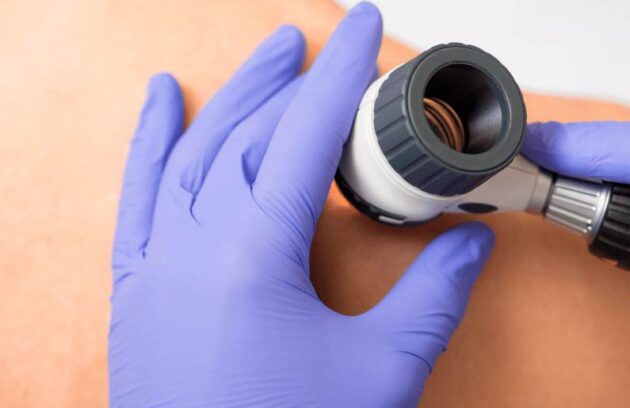 spx-clinica-spx-imagem-novo-tratamento-acelera-cura-da-hanseniase