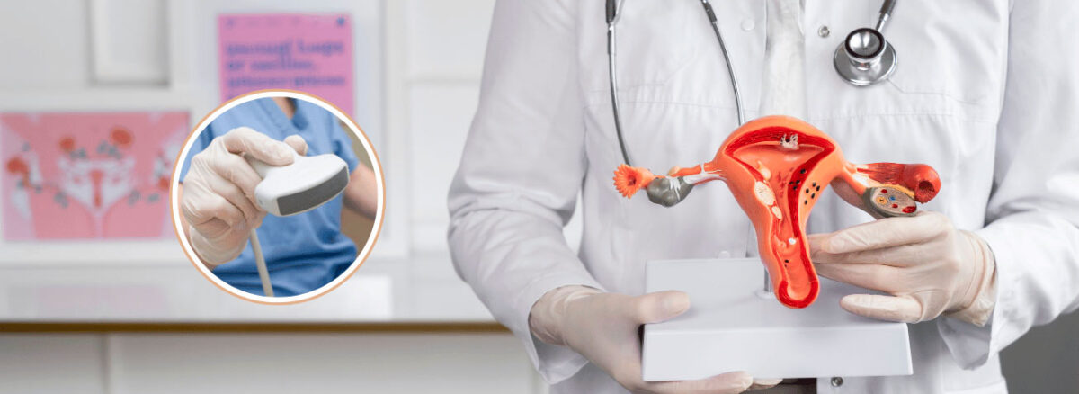 spx-clinica-spx-imagem-para-que-serve-o-ultrassom-transvaginal