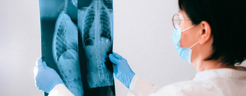 spx-clinica-spx-imagem-raio-x-da-coluna-para-dores-nas-costas