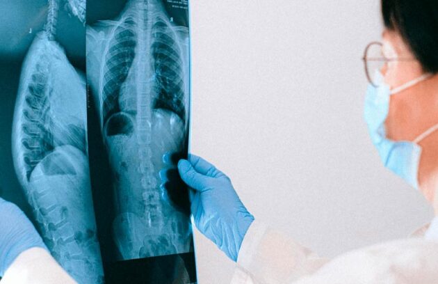 spx-clinica-spx-imagem-raio-x-da-coluna-para-dores-nas-costas