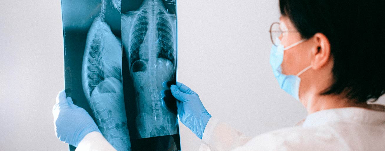 spx-clinica-spx-imagem-raio-x-da-coluna-para-dores-nas-costas