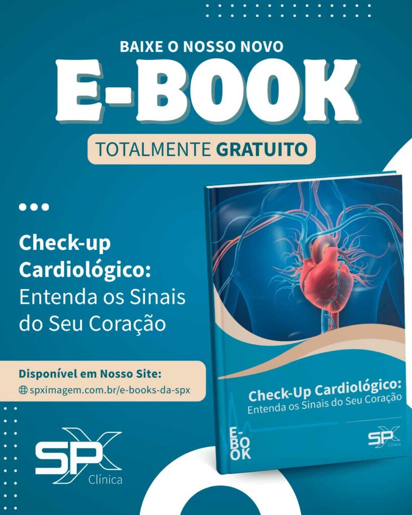 E-book check-up cardiológico da SPX Diagnóstico por Imagem