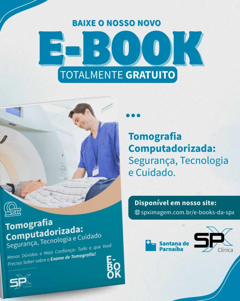 E-book sobre o exame de Tomografia da SPX Diagnóstico por Imagem