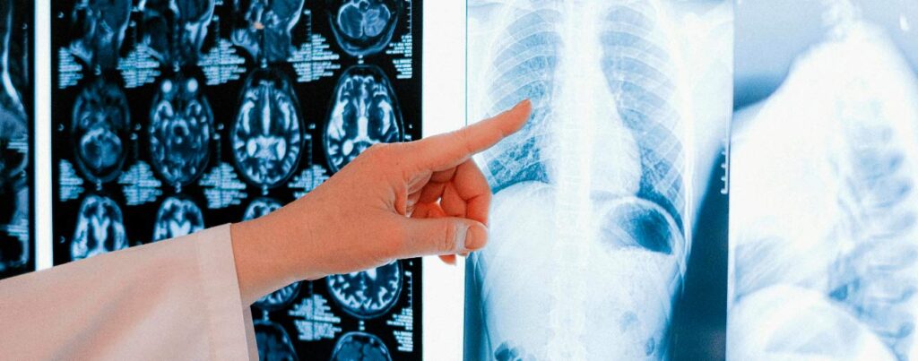 spx-clinica-spx-imagem-exame-de-raio-x-com-contraste