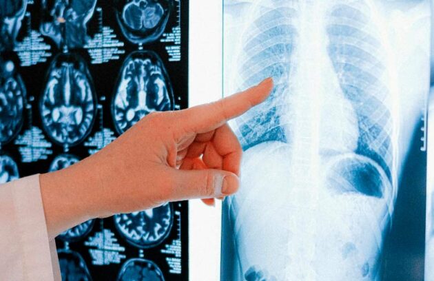 spx-clinica-spx-imagem-exame-de-raio-x-com-contraste