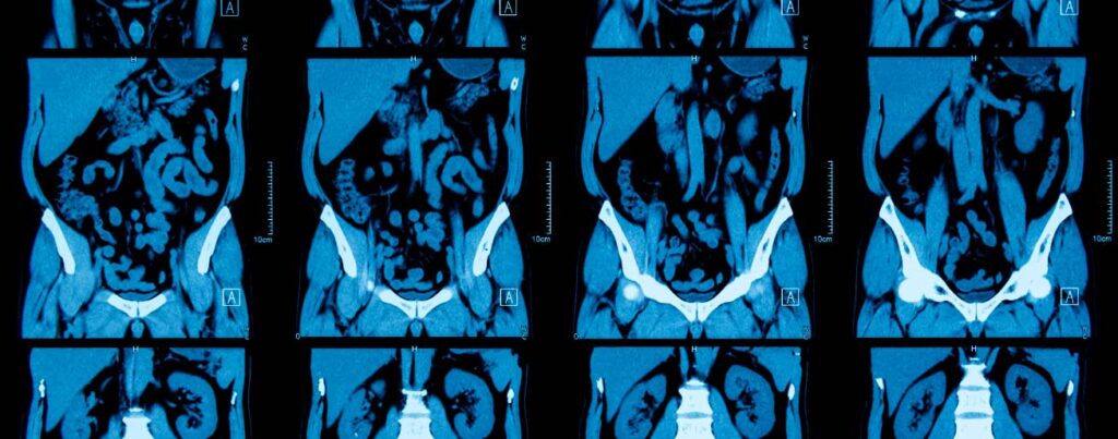 spx-clinica-spx-imagem-exame-de-tomografia-do-abdomen